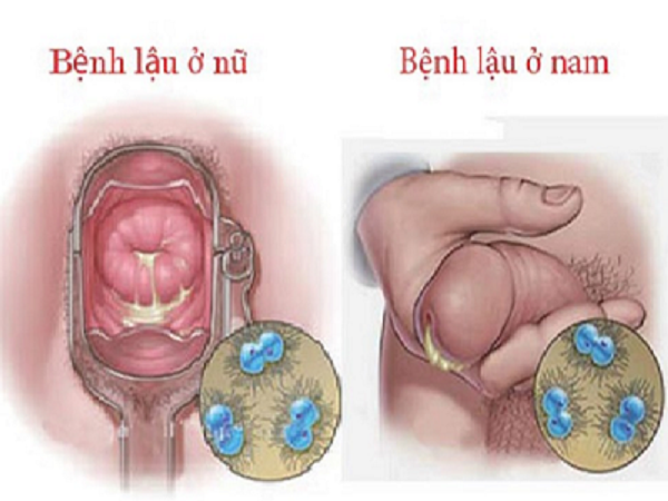 Quan hệ bằng Miệng có nên không? 8 Tư thế Thú Vị Nên Thử - Vật lý trị liệu